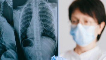 Nasce MEDUSA, l’IA che prevede l’evoluzione clinica dei pazienti