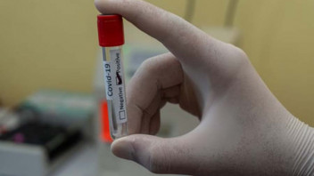Further vaccination appointments at the Brixen-Bressanone and Bozen-Bolzano campuses